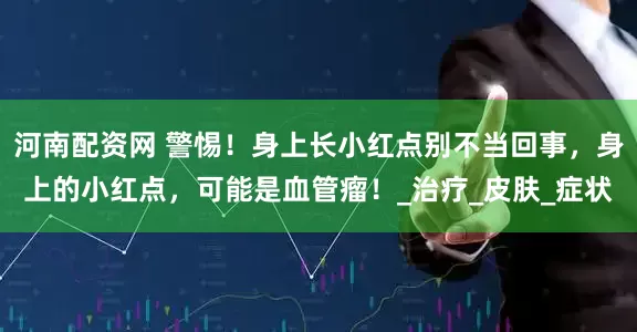 河南配资网 警惕！身上长小红点别不当回事，身上的小红点，可能是血管瘤！_治疗_皮肤_症状